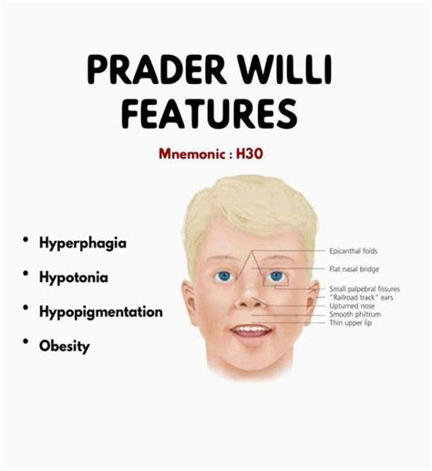 prada will|prader willi syndrome symptoms.